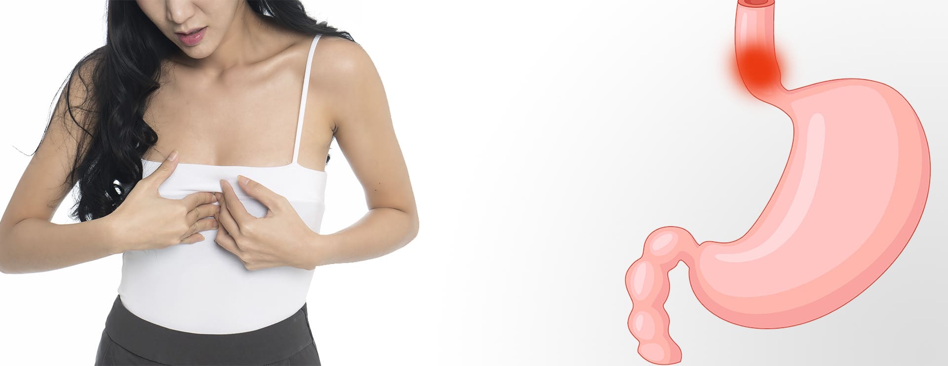 tratamiento de hernia hiatal