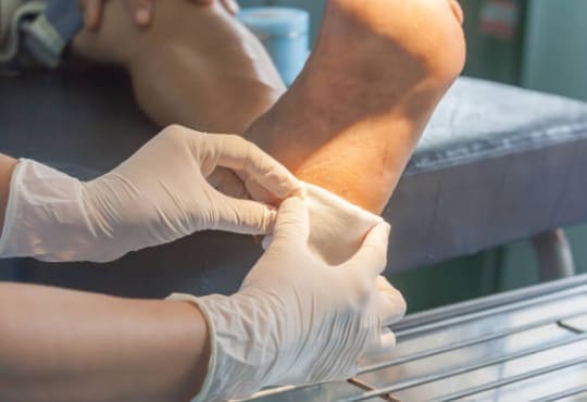 medico cirujano pie diabetico