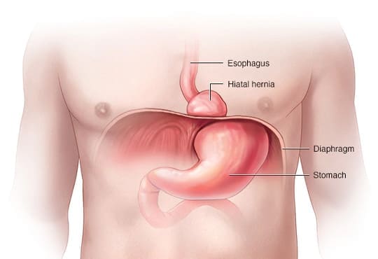 medico cirujano colitis
