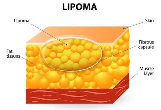 medico cirujano apendicectomia